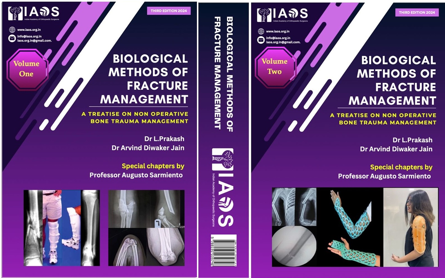 Biological Methods of Fracture Management