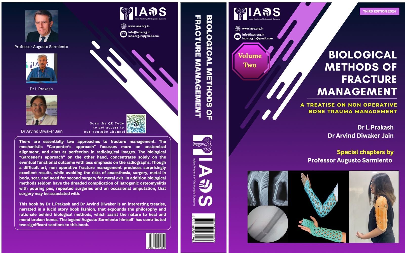Biological Methods of Fracture Management